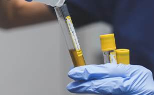 Infección vias urinarias